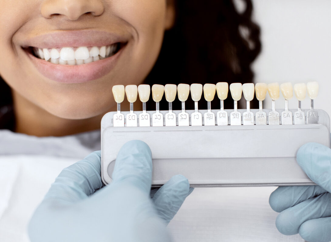 stomatologist-holding-dental-teeth-shade-guide-cha-2025-03-18-18-01-22-utc (1) (2)