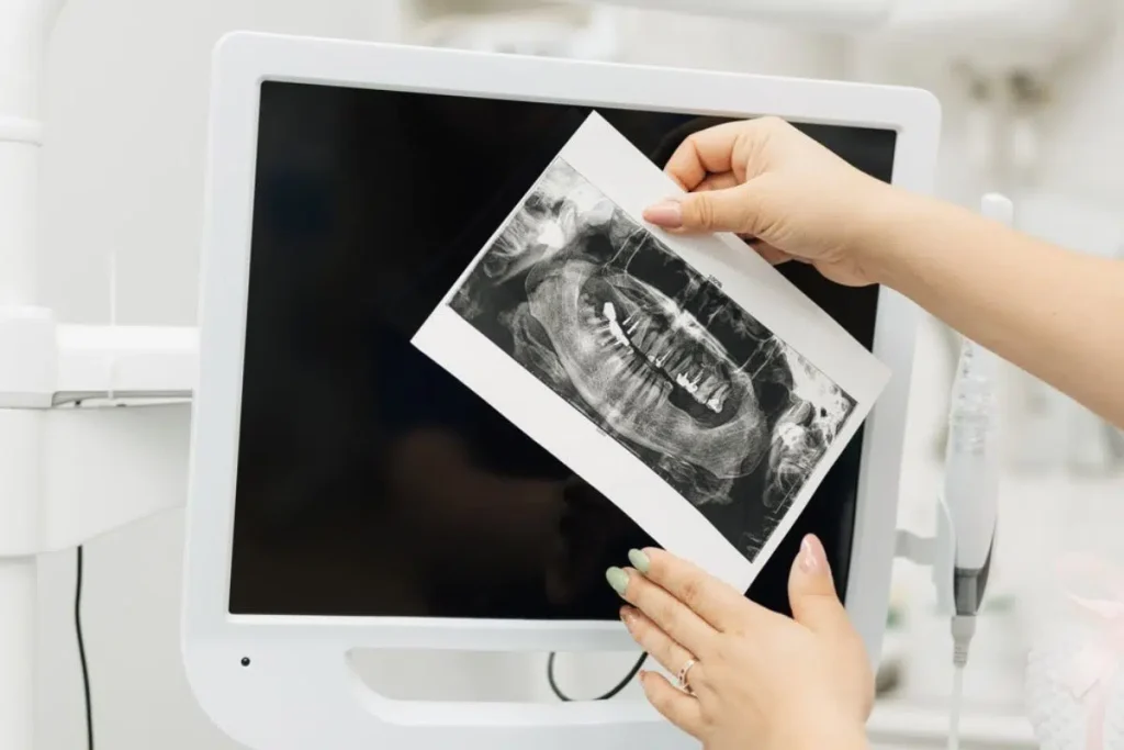 Oral Cancer Screening in Oakville