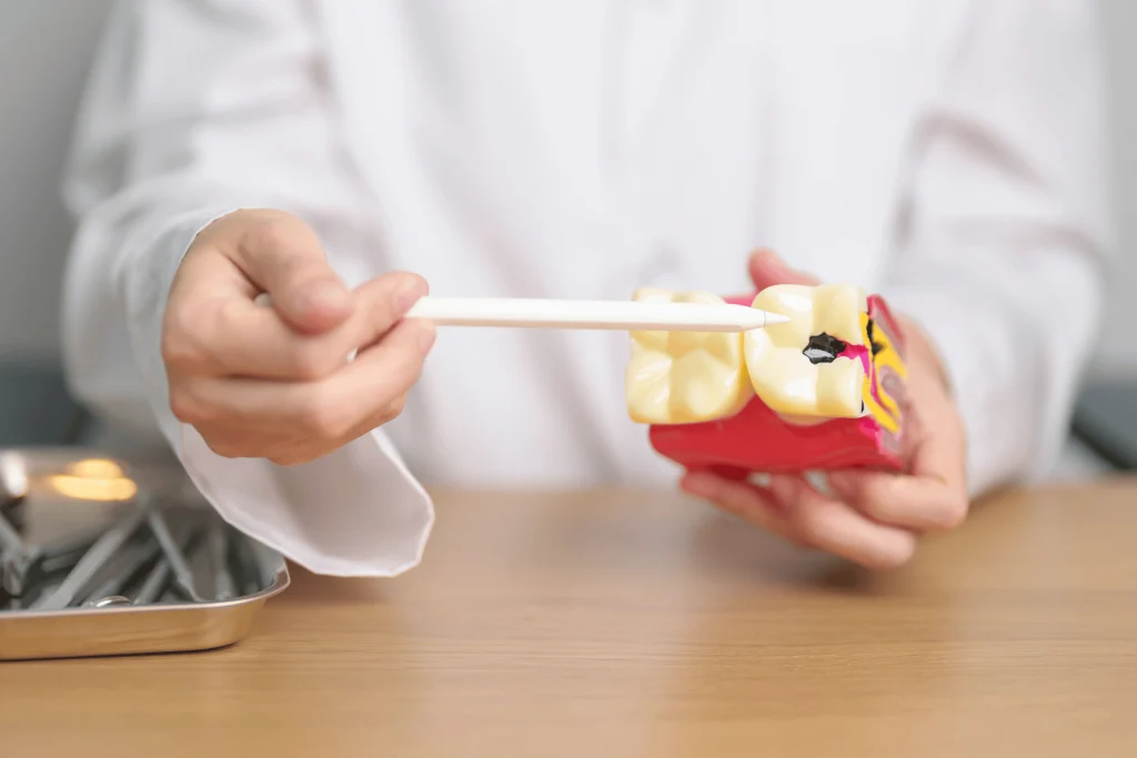 Tooth Extractions in Oakville