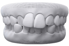 Invisalign Clear Aligner in Oakville