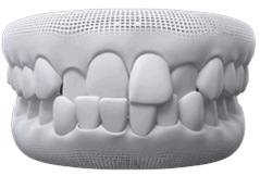 Invisalign Clear Aligner in Oakville