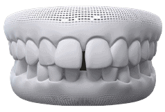 Invisalign Clear Aligner in Oakville