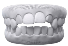 Invisalign Clear Aligner in Oakville