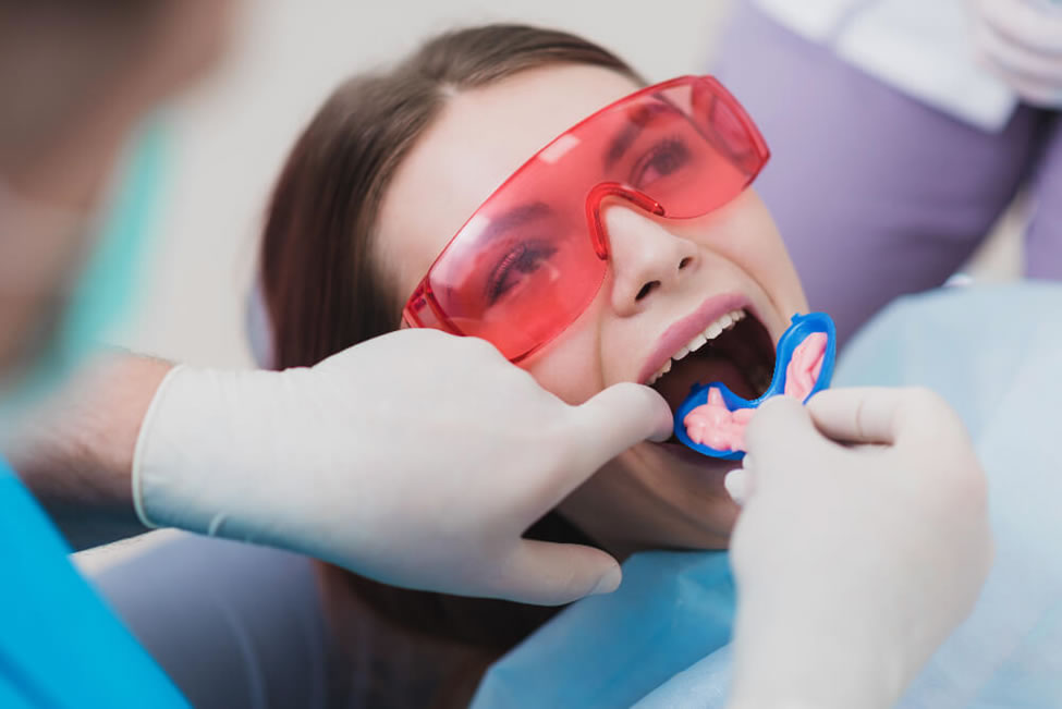 Fluortide Treatment in Oakville