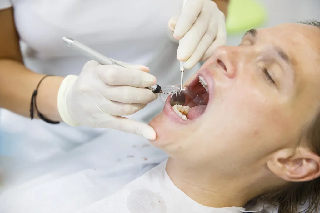 Root Canal Treatment in Oakville