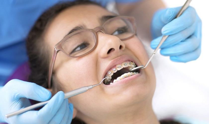 Tooth Extractions in Oakville