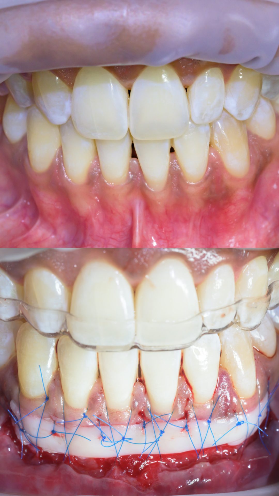 AEB328B3-7A3E-4678-9D7E-0422A928E277