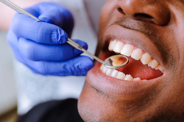 oral-hygiene-1